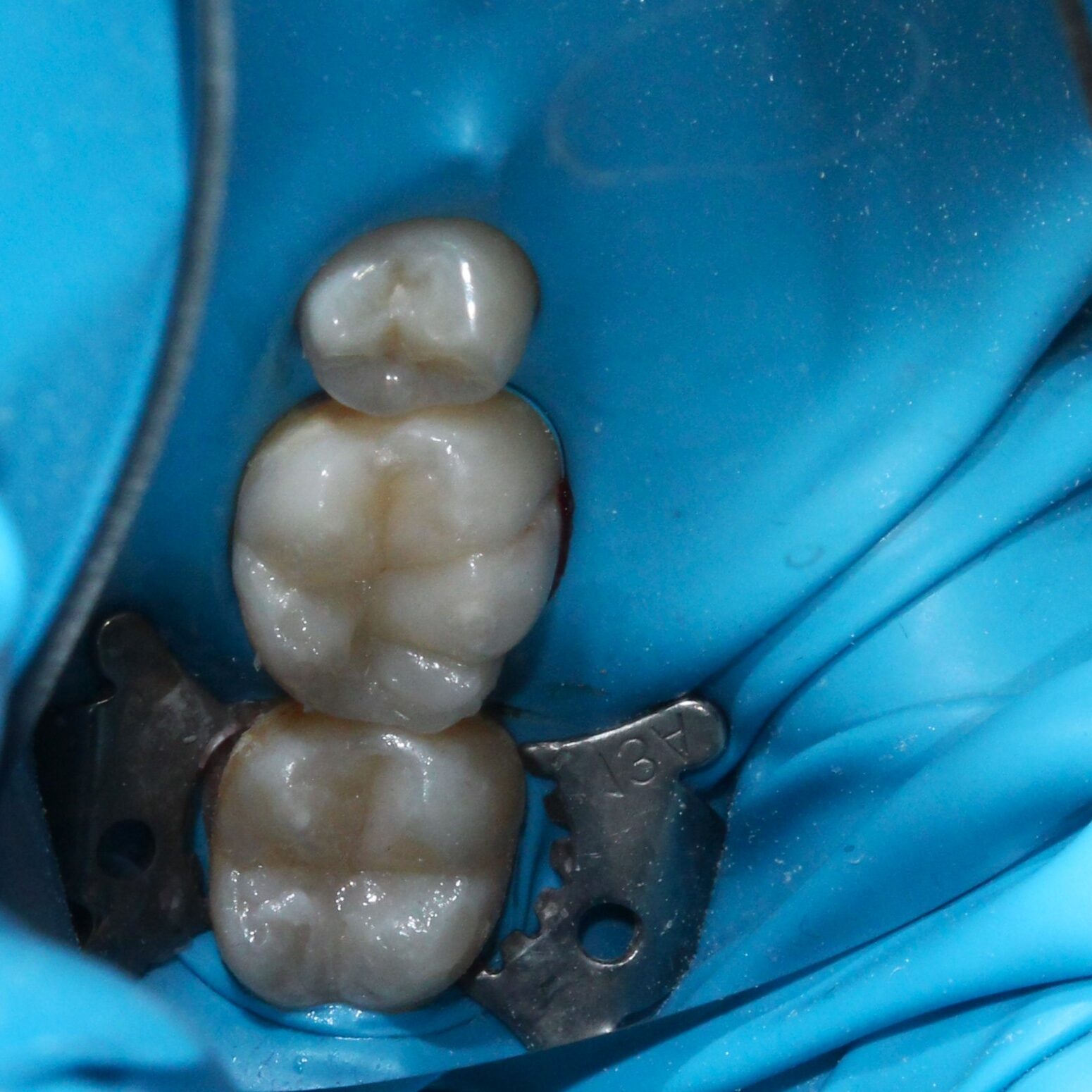 After image