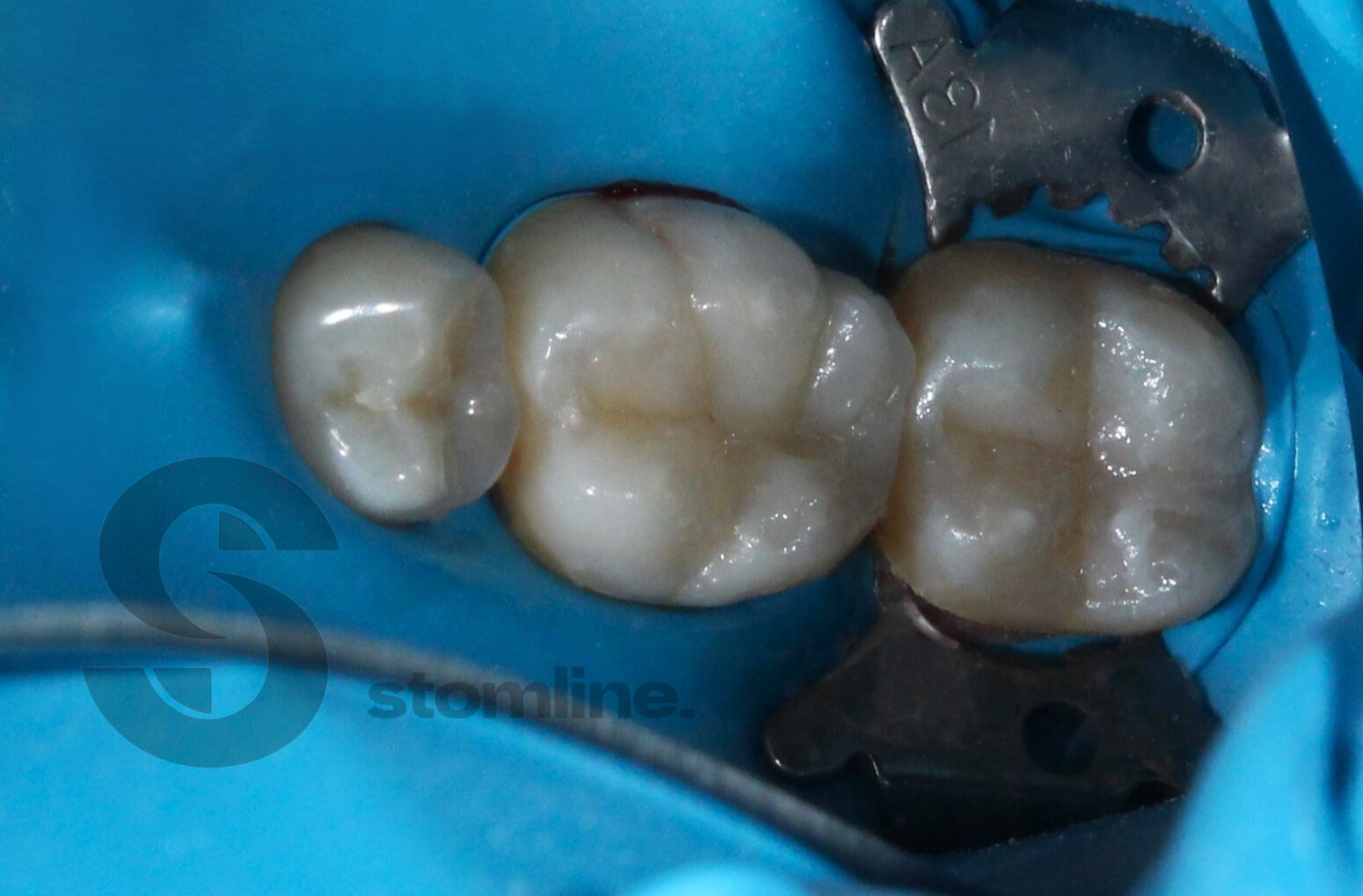 After image