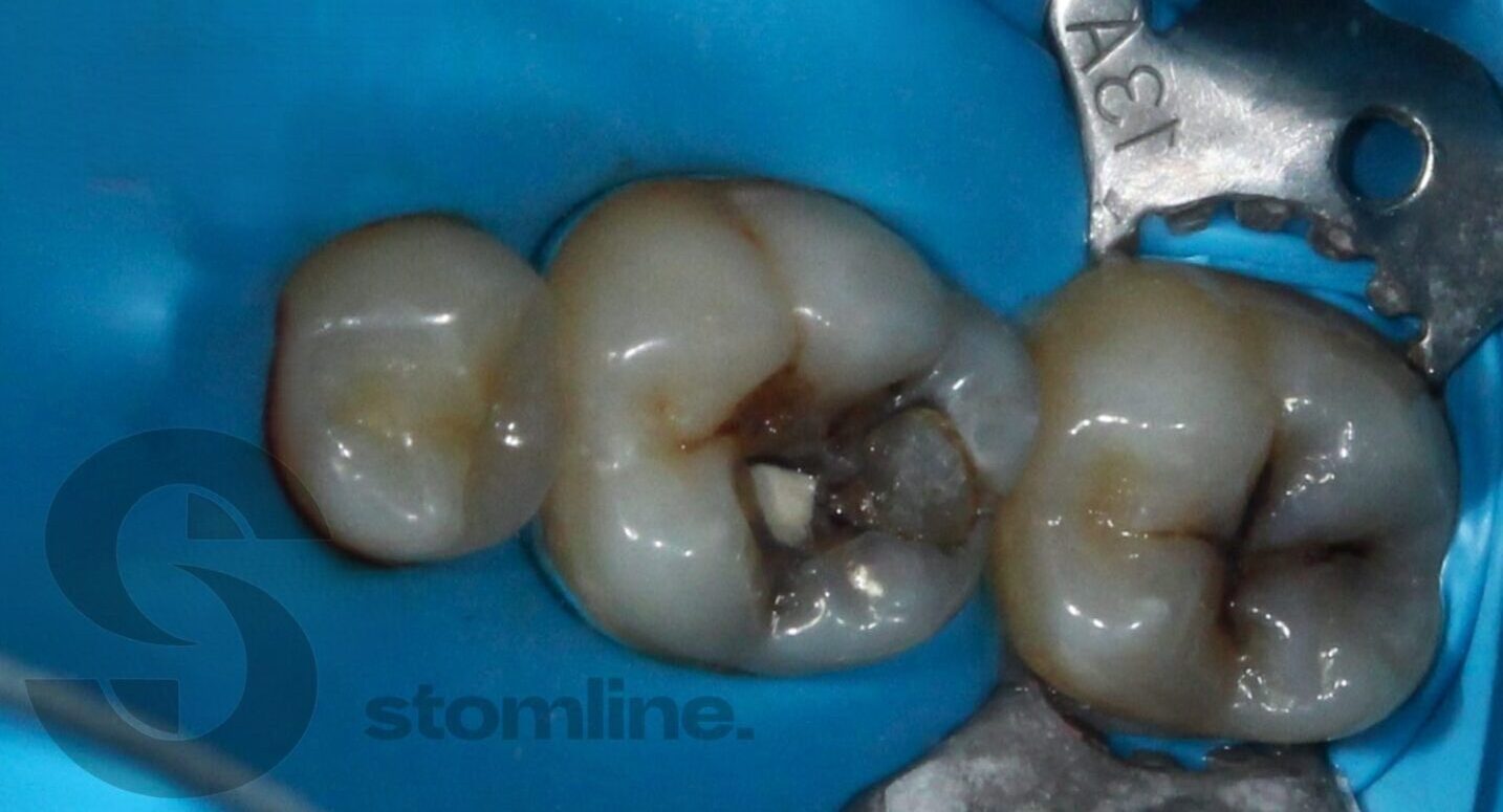 Before image